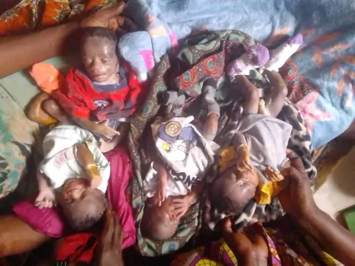 Kasaï : une femme donne naissance à des quadruplés à Biponga